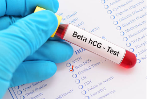exame beta hcg